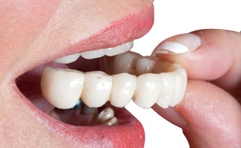 Teeth Crowns & Bridges