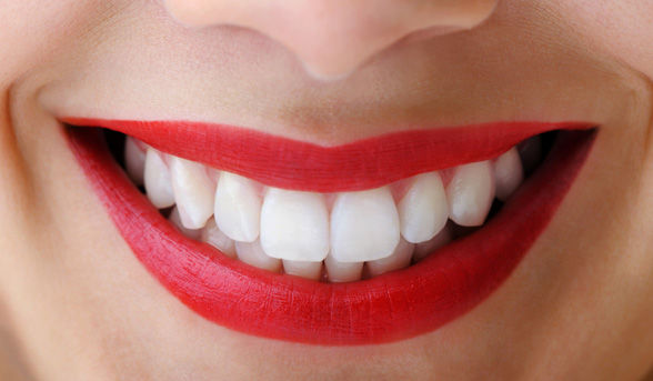 Teeth Whitening